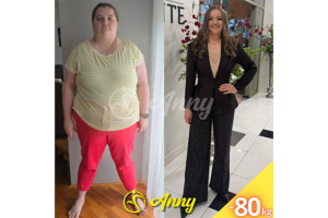 VIDEO: Nevjerojatna transformacija: Matea smršala 80 kilograma i postala inspiracija mnogima