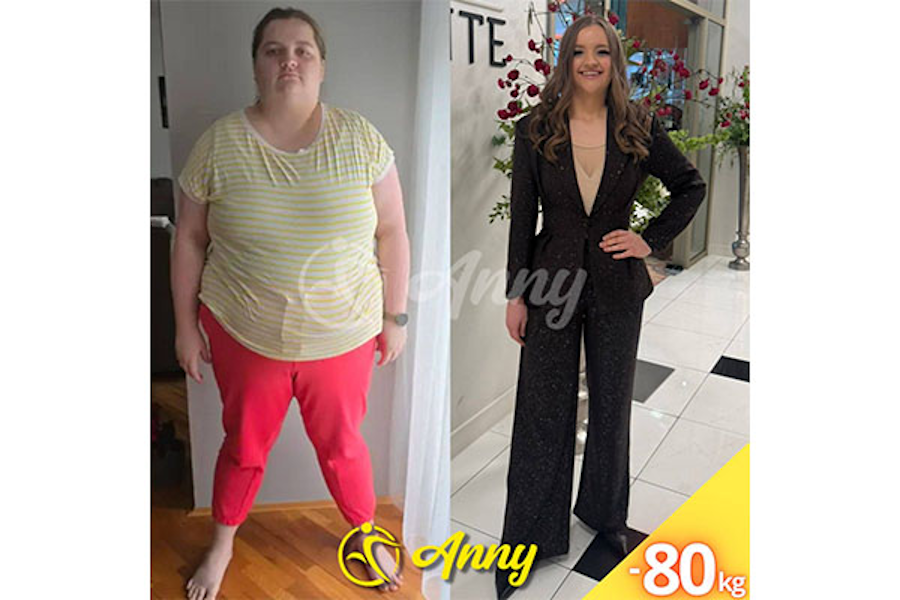 VIDEO: Nevjerojatna transformacija: Matea smršala 80 kilograma i postala inspiracija mnogima